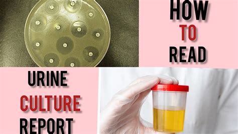 A Pocket Guide To Know Everything About Urine Re .